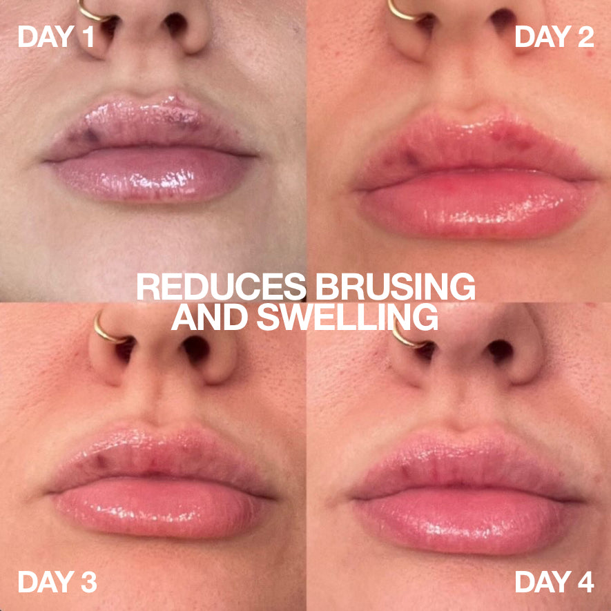 WHOLESALE - BOWLER Lip Gloss - Renewal Treatment